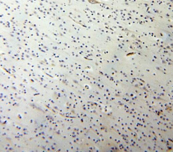 SQOR Rabbit Polyclonal Antibody