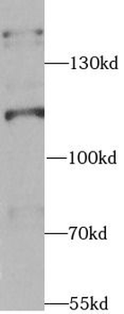 U2SURP Antibody