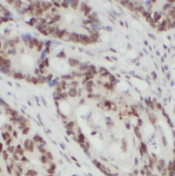 U2SURP Rabbit Polyclonal Antibody