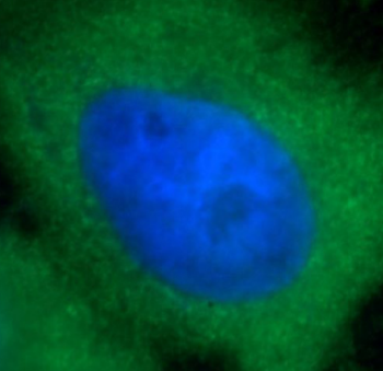 SRC Rabbit Polyclonal Antibody