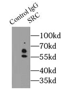 SRC Rabbit Polyclonal Antibody
