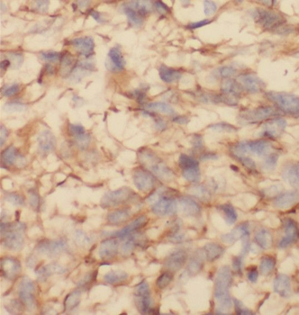 SRP68 Rabbit Polyclonal Antibody