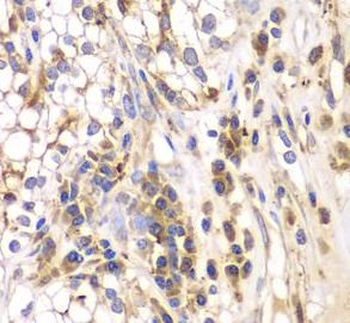 SRPK1 Rabbit Polyclonal Antibody