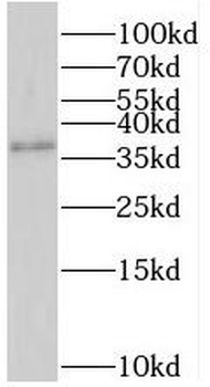 SRR Antibody