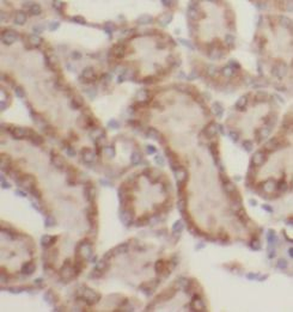 SSTR2 Rabbit Polyclonal Antibody
