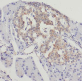 SSTR3 Antibody
