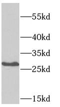 SSX5 Rabbit Polyclonal Antibody