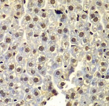 SSX5 Rabbit Polyclonal Antibody