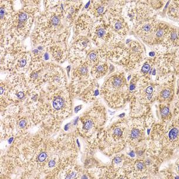 ST3GAL3 Rabbit Polyclonal Antibody