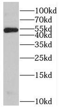 ST3GAL4 Rabbit Polyclonal Antibody