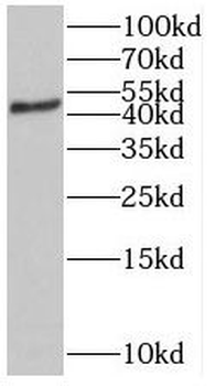ST3GAL5 Rabbit Polyclonal Antibody