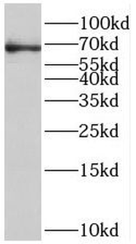 ST6GALNAC1 Antibody