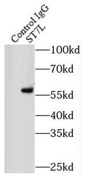ST7L Rabbit Polyclonal Antibody