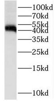 ST8SIA1 Antibody