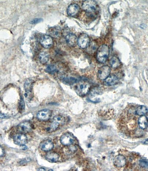 STAC2 Rabbit Polyclonal Antibody