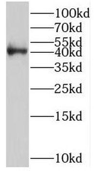 STAC3 Rabbit Polyclonal Antibody