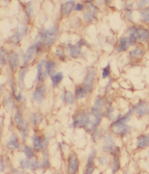 STAC3 Rabbit Polyclonal Antibody