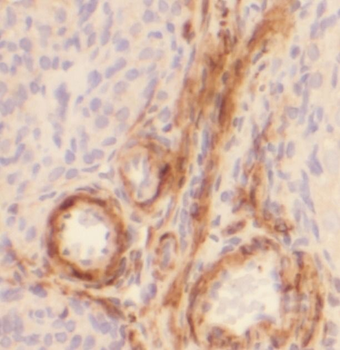 STAR Rabbit Polyclonal Antibody