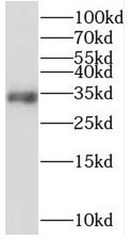 STARD7 Antibody