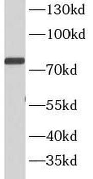 STAT4 Rabbit Polyclonal Antibody