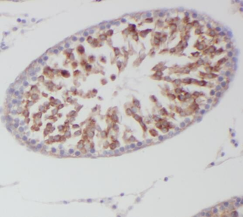 STAT4 Rabbit Polyclonal Antibody