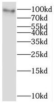 STAT5A Rabbit Polyclonal Antibody