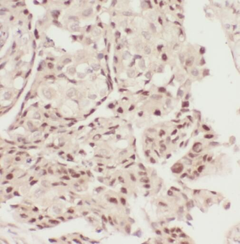 STAT5A Rabbit Polyclonal Antibody