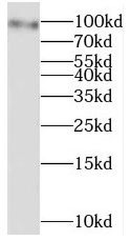 STAT5A Rabbit Polyclonal Antibody