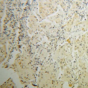 STAT5A Rabbit Polyclonal Antibody