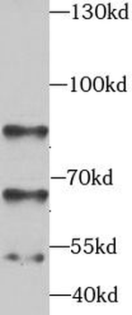 STK3 Rabbit Polyclonal Antibody