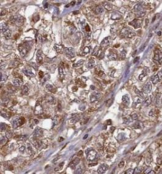 STK3 Rabbit Polyclonal Antibody