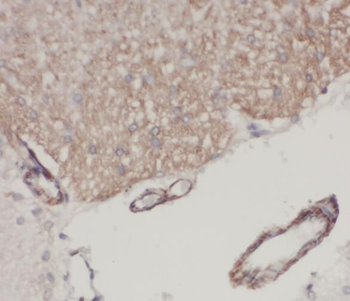 STK32A Rabbit Polyclonal Antibody