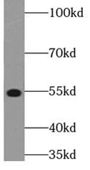 STK38L Rabbit Polyclonal Antibody