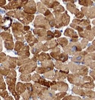 STK38L Rabbit Polyclonal Antibody