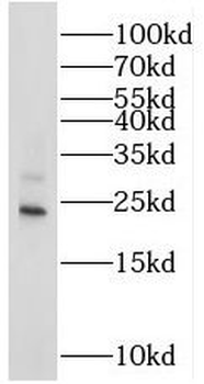 STMN3 Antibody