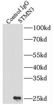 STMN3 Rabbit Polyclonal Antibody
