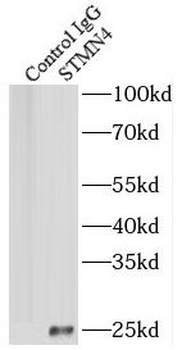 STMN4 Rabbit Polyclonal Antibody