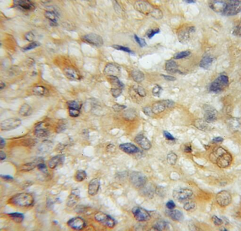 STMN4 Rabbit Polyclonal Antibody