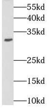 STOM Antibody