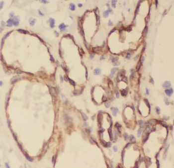 STOML1 Rabbit Polyclonal Antibody