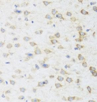 STRN Rabbit Polyclonal Antibody
