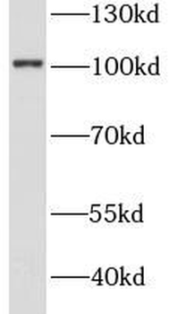STT3A Antibody