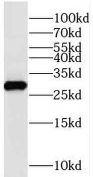 STXBP6 Antibody