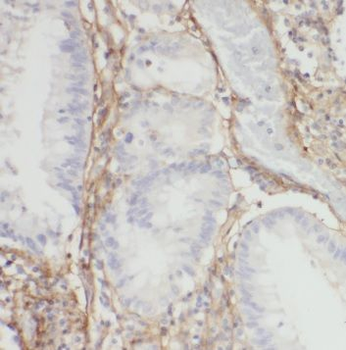 SUCLA2 Rabbit Polyclonal Antibody