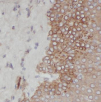 SULF2 Rabbit Polyclonal Antibody
