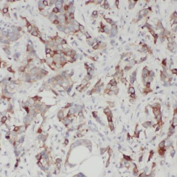 SULT1A3 Rabbit Polyclonal Antibody