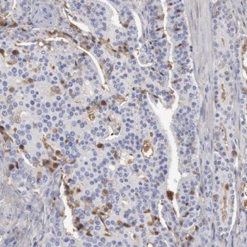 SULT1C2 Rabbit Polyclonal Antibody