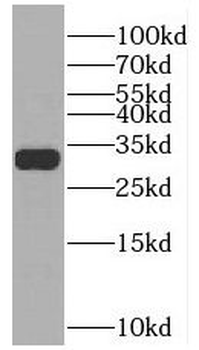 SULT4A1 Antibody
