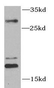 SUMO1 Rabbit Polyclonal Antibody