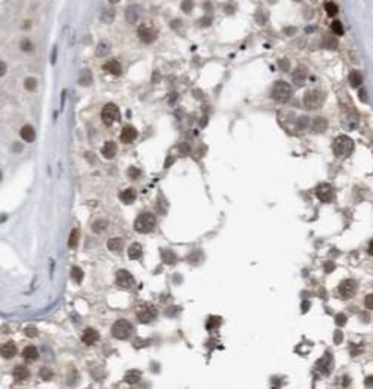 SUMO1 Rabbit Polyclonal Antibody